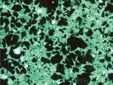 Grün-fluoreszierende HEK-Zellen, Äkta-Chromatographieanlage zur Proteinreinigung